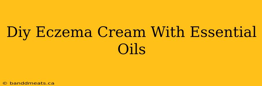 Diy Eczema Cream With Essential Oils